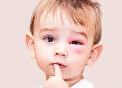 Le top 10 des accidents domestiques:  En 8e place la piqûre