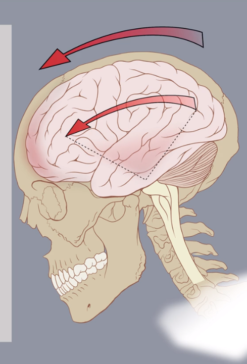 Le top 10 des accidents domestiques:  En 1ère place, la chute