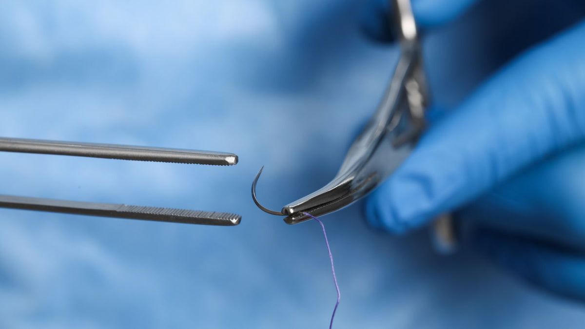 Ginette doit-elle avoir des points suture?